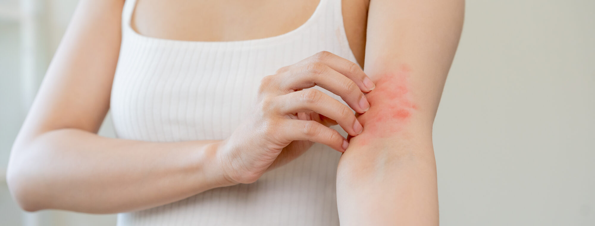 A woman at urgent care has a skin rash.